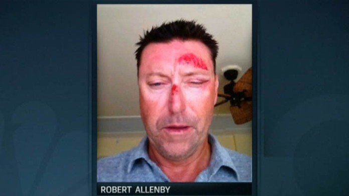 Robert Allenby, golf, unos.