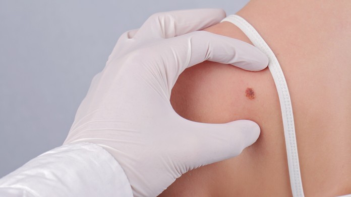 Kožné vyšetrenie u lekára