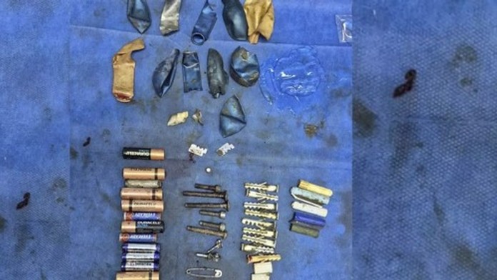 V žalúdku mal 56 kovových predmetov. Pätnásťročný chlapec operáciu neprežil