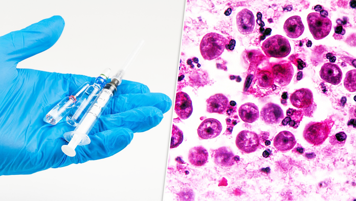 Českí vedci objavili nádej proti smrteľnej amébe (ilustračná snímka)