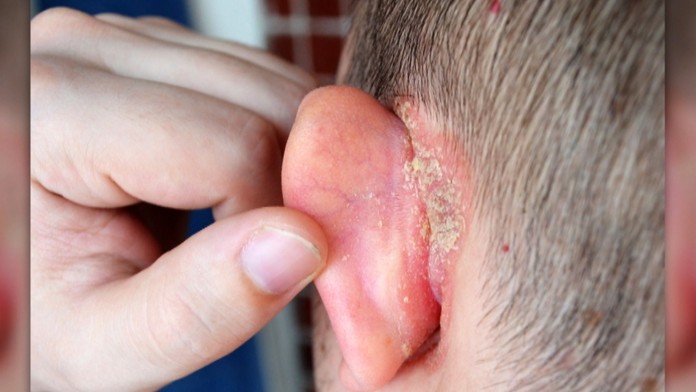 Ilustračná snímka