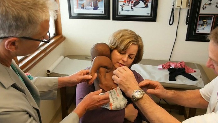 Dievčatko sa narodilo so štyrmi nohami a dvomi chrbticami