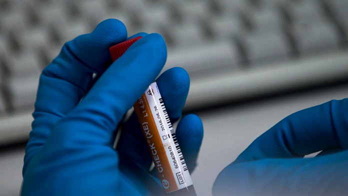 Na archívnej snímke zamestnanec ruského laboratória na doping drží vzorku krvi. (ilustračné foto)