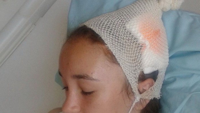 Natáliu s ťažkým poranením hlavy na archívnej snímke.