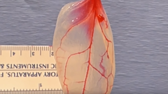 Vedci vytvorili srdcové tkanivo zo špenátu.