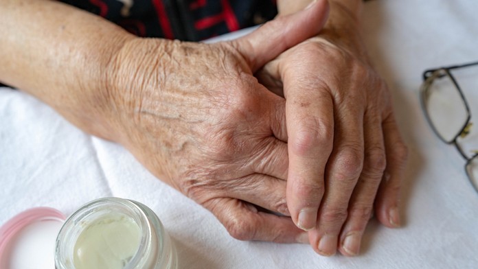 Na snímke sú ruky staršej ženy.