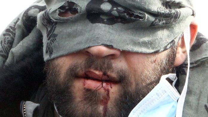 Migranti si na protest proti rušeniu tábora zašili ústa.