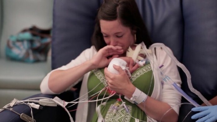 Predčasne narodený Ward Scot s matkou