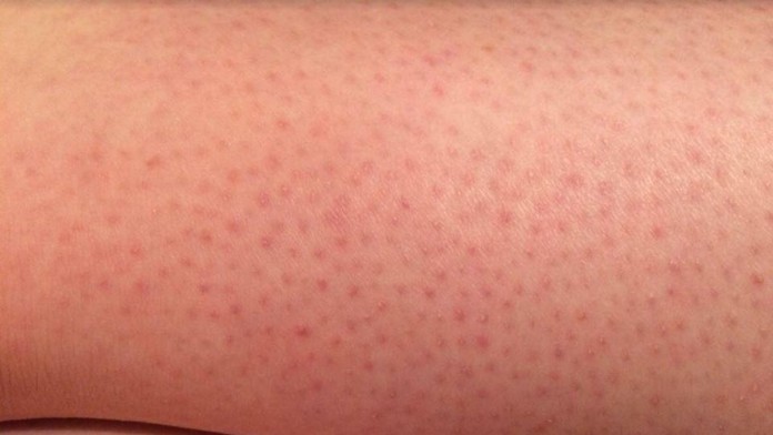 Dopadnete po holení takto? Môže za to nechutnosť, ktorú robí skoro každý