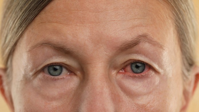 Problémy s očami, ilustračná snímka.