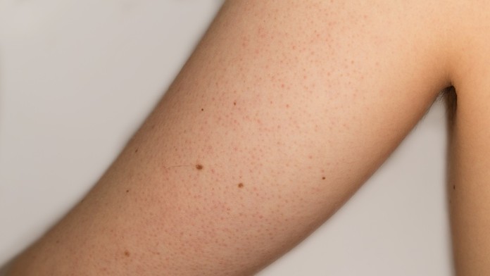 Červené bodky na rukách