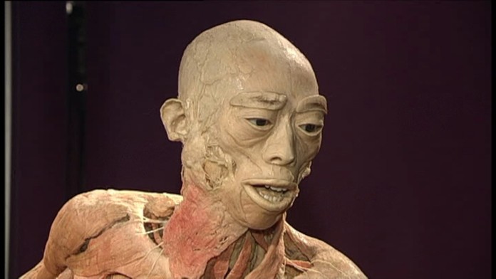 Výstava ľudských tiel. 