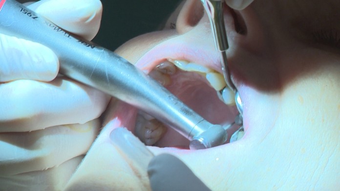 Pre zubárkin podvod jej poisťovňa nepreplatila korunku. Pani Oľga tak prišla o 100 eur