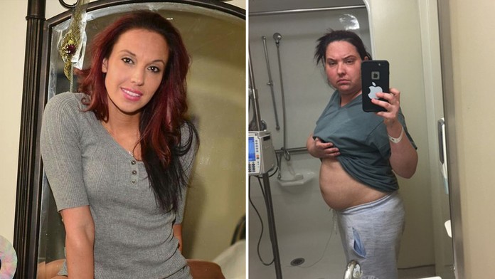 Choroba ju zmenila na nepoznanie.