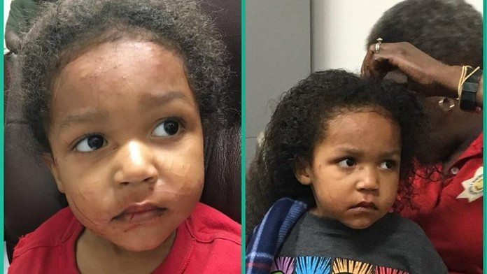 Kyle prežil s bračekom 4 dni vo vraku auta