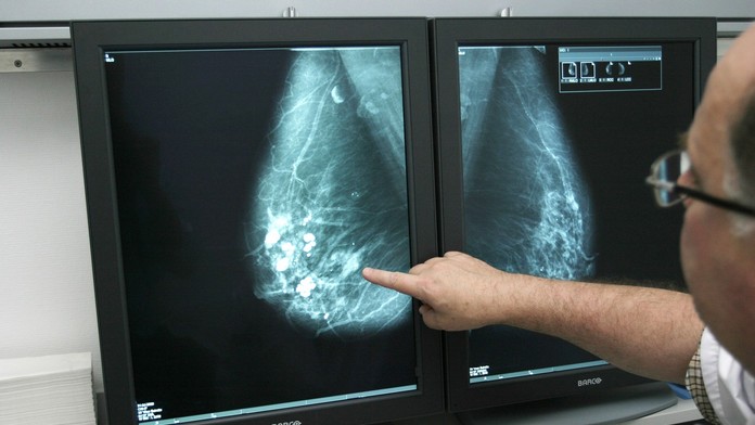 Ultrasonografia, snímok prsníka 