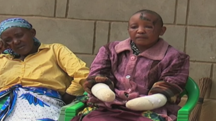 Odťal jej ruky a zohavil tvár.