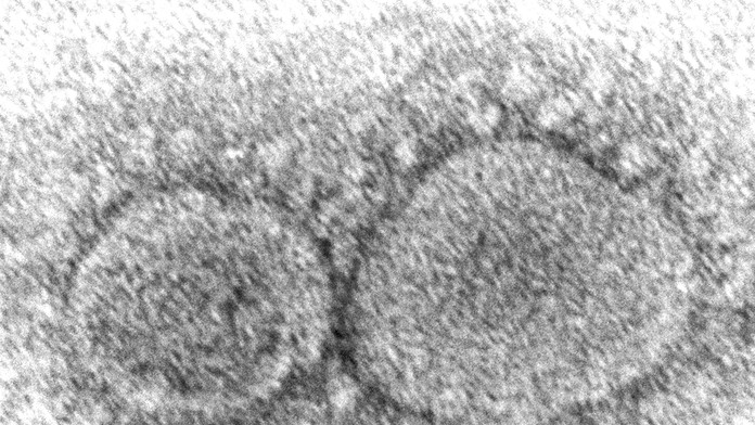 Nový variant koronavírusu sa môže rozšíriť po celej Európe, varuje maďarský expert