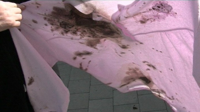 19 LV Nehoda v nemocnici.transferweb_jpg_bez_watermarku_1.jpg