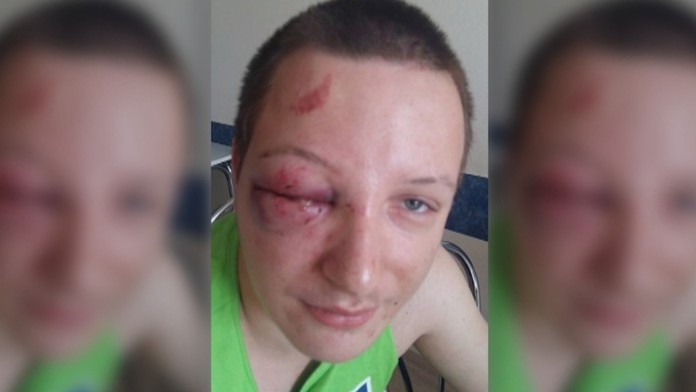 Dobitá tvár mladého muža.