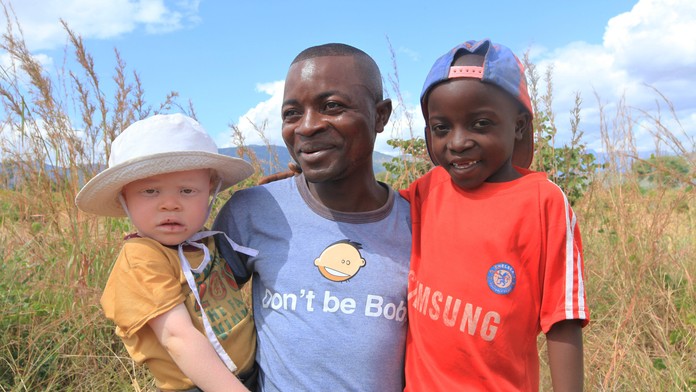 Razik Jaffalie sa vzdal práce, aby ochránil svojho syna Cassima pred rastúcimi útokmi na albínov..jpg