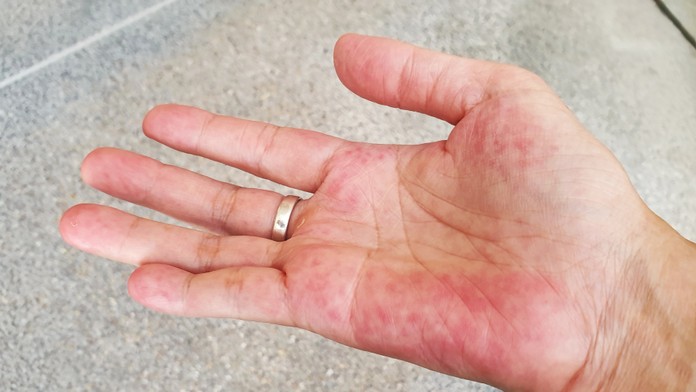 Únava nemusí prísť len s jesenným počasím. Tichého zabijaka indikujú viaceré príznaky