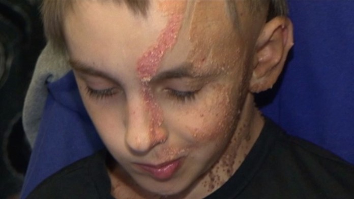 Choroba mu spôsobuje na tele tumory a zvyšuje riziko rakoviny