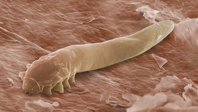 Mikroskopické roztoče Demodex