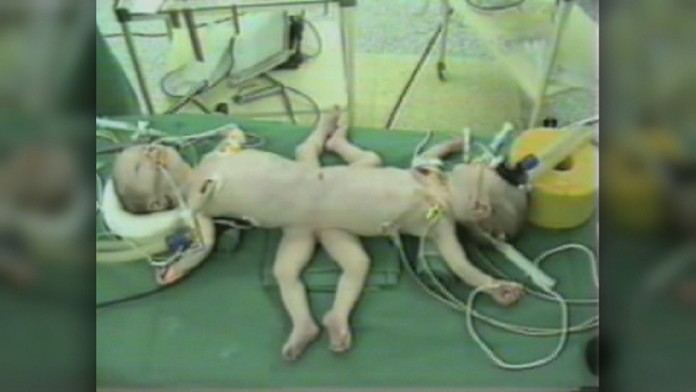 Prvým tohtoročným Slovákom je Šimonko, vyzerá to na prevahu chlapcov.