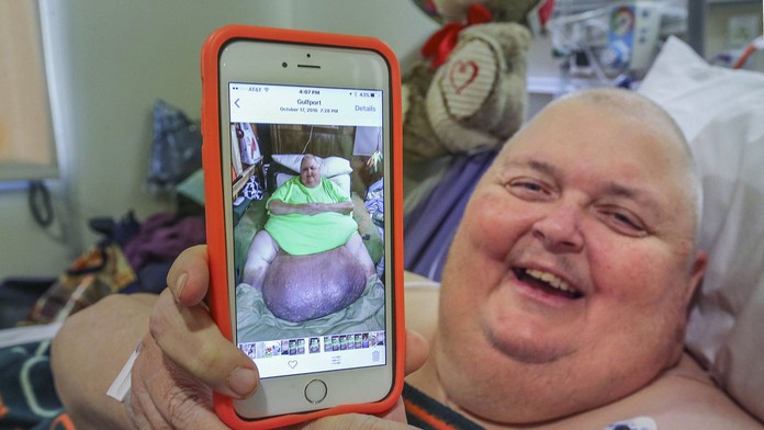 Tumor mu už nedovolil chodiť.