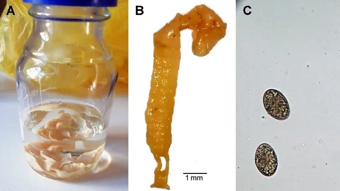 V Česku sa prvýkrát objavila nebezpečná choroba. Zrejme ju tam zavliekol turista