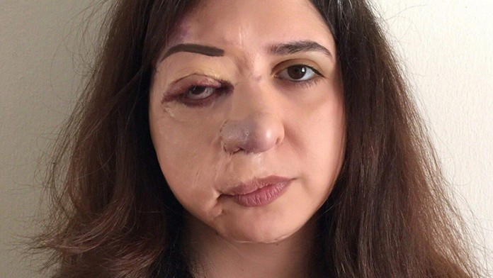 Vegánski rodičia z Austrálie takmer vyhladovali dcéru na smrť