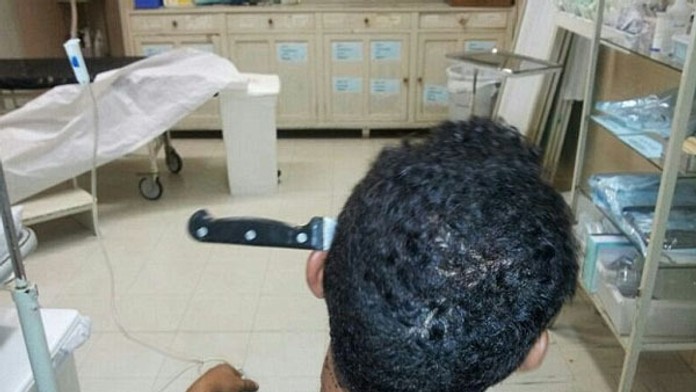 Muž prežil, hoci v hlave mal zapichnutý dlhý nôž 