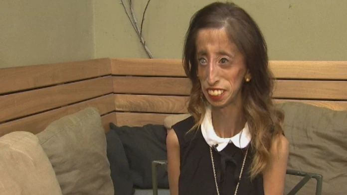 Najškaredšia žena na svete Lizzie Velasquezová.