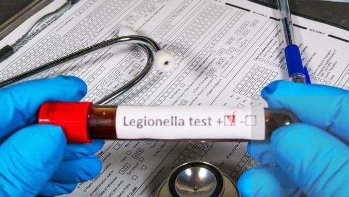 V hotelovej vírivke v Demänovskej Doline potvrdili prítomnosť baktérie Legionella