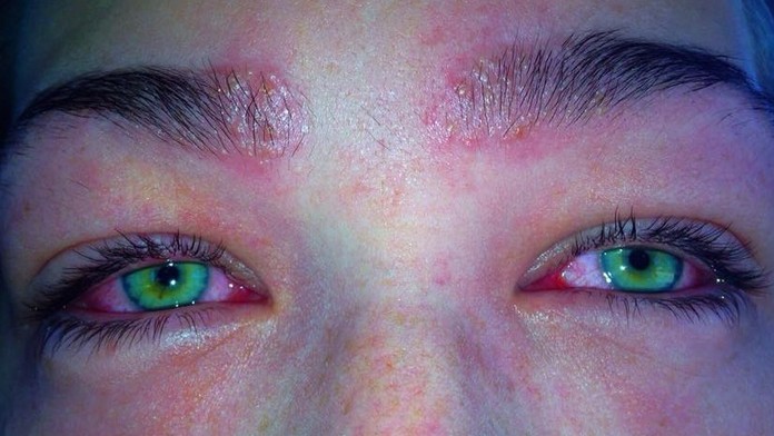 Behom chvíľky sa z krásky stalo toto.