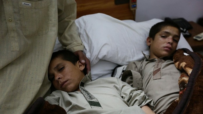 Pakistanskí bratia majú veľmi zvláštnu poruchu.