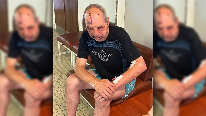 Medvedica sa mužovi v Kremnických vrchoch zahryzla do čela. V nemocnici nám opísal útok