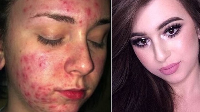 2F8E7FCB00000578-3369485-image-m-13_1450737569116 (1).jpg