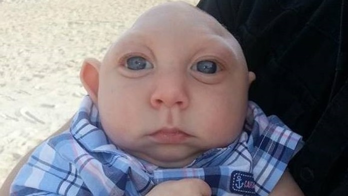 Jaxon Emmett Buell, keď mal jeden rok