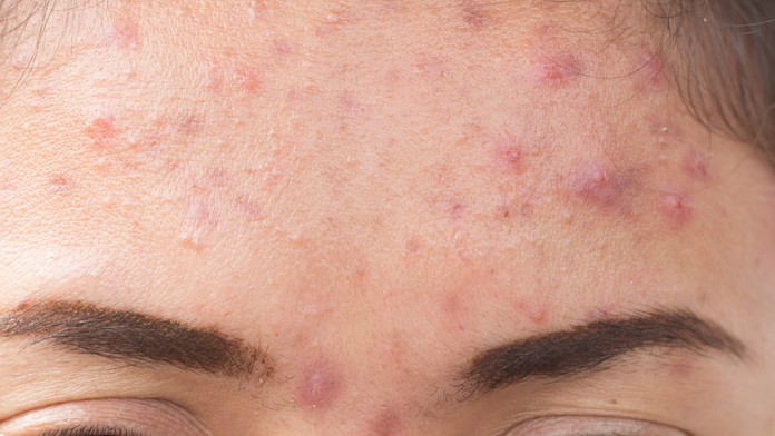 Ilustračná snímka