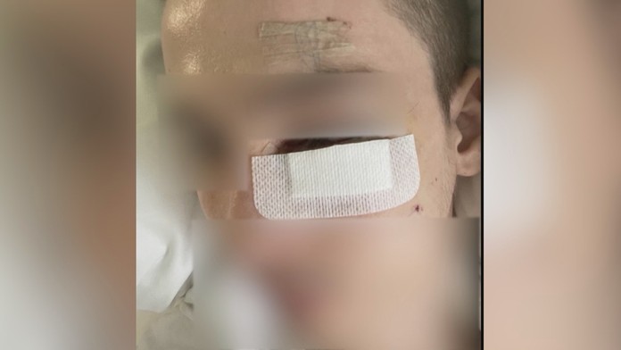 Zbitý 22-ročný mladík v Prešove.