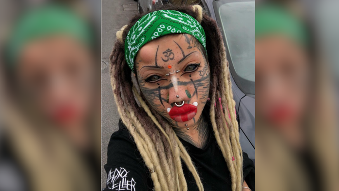 FOTO: Svojím vzhľadom poburuje ľudí. „Ľudská mačka“ s úpravami ani zďaleka nekončí