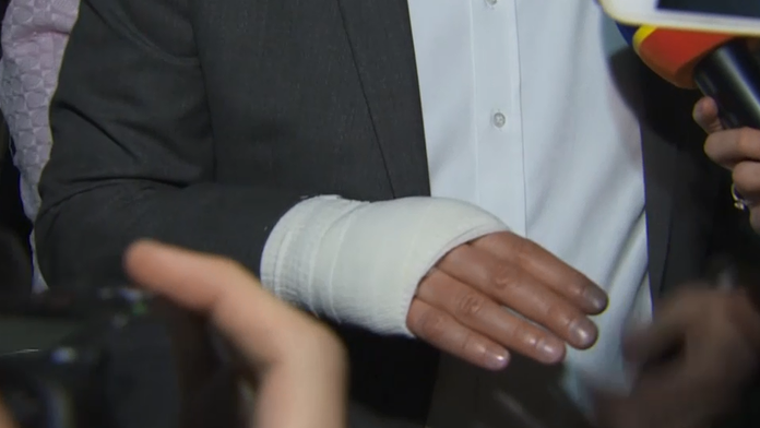 Zranená ruka Richarda Sulíka