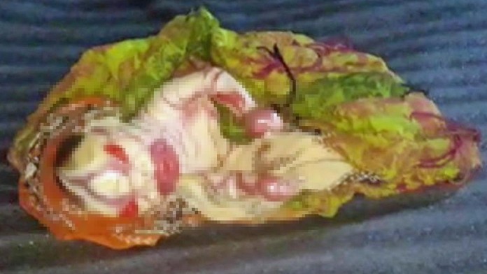 Dievčatko sa narodilo predčasne. 