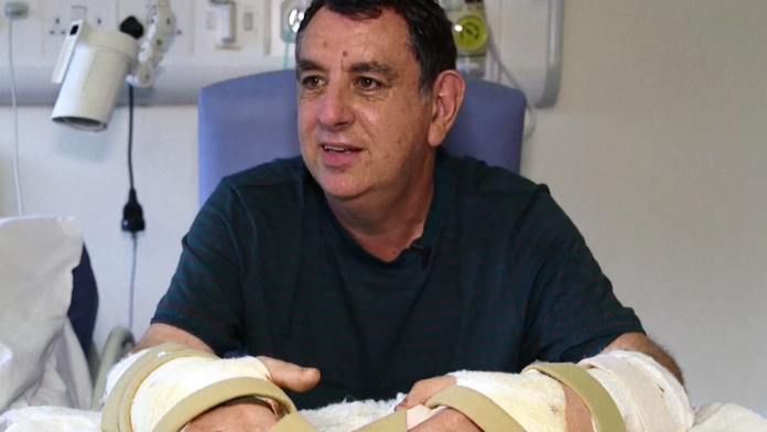 Ruky dostal od darcu.