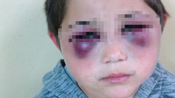 Osemročného dobitého chlapca našli obecní policajti v Tekovských Lužanoch. 