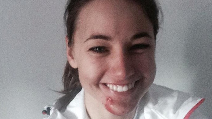 Stromková a jej zranená brada-uvod.jpg