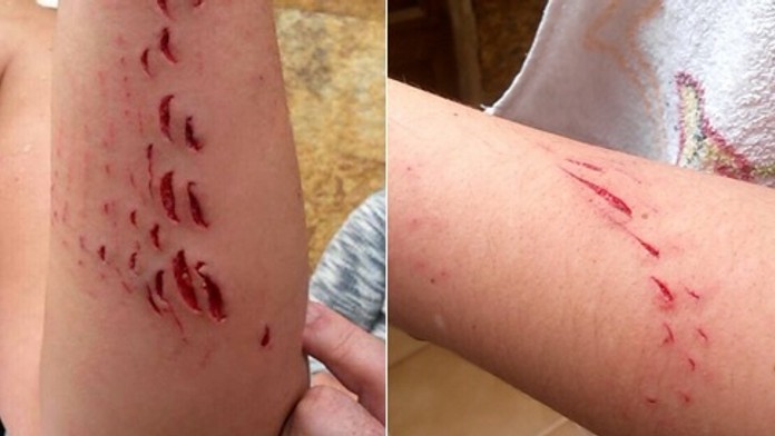 Cristina najprv slabému hrýzeniu nevenovala pozornosť