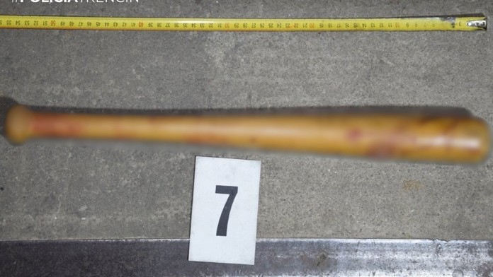 Keď ju policajti zaistili, bola ešte od krvi. Muž brutálne zmlátil bejzbalkou dvoch ľudí